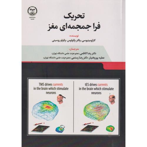 تحریک فراجمجمه ای مغز ، کاظمی ، جهادتهران